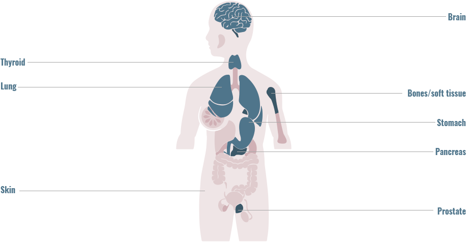 Distribution of BRAF/CRAF gene fusions across primary tumor sites graphic